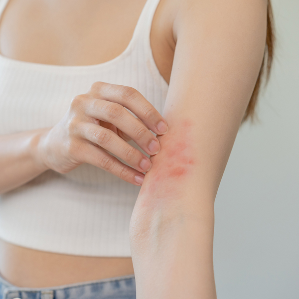 Allergy testing and microbiome analysis in Geelong